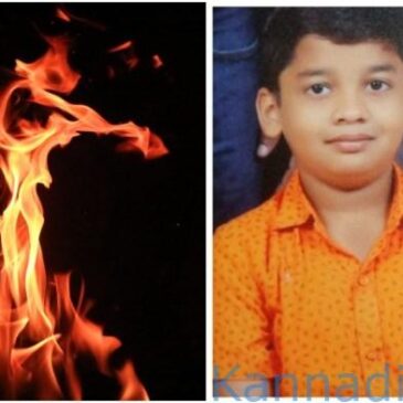 ಹೀಗೊಂದು ಆಘಾತಕಾರಿ ಘಟನೆ : ಯೂ ಟ್ಯೂಬ್‌ನಿಂದ ಪ್ರೇರಿತನಾಗಿ ಸೀಮೆಎಣ್ಣೆ -ಬೆಂಕಿಪೊಟ್ಟಣ ಬಳಸಿ ಕೂದಲು ನೇರಗೊಳಿಸಲು ಯತ್ನಿಸಿದ ಬಾಲಕ ಸಾವು