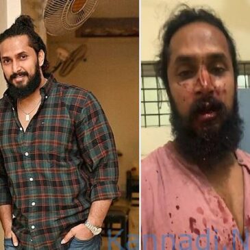 ಬೆಂಗಳೂರು: ನಟ ಚೇತನ್ ಚಂದ್ರ ಮೇಲೆ ಹಲ್ಲೆ