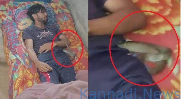 ವೀಡಿಯೊ…| 10 ಸಲ ಕಚ್ಚಿದ ವಿಷಕಾರಿ ಹಾವು ಶವದ ಪಕ್ಕದಲ್ಲೇ ಬೆಳಗಿನ ತನಕ ಮಲಗಿತ್ತು ; ಆದ್ರೆ ಕತ್ತುಹಿಸುಕಿ ಕೊಲೆಯಾಗಿದ್ದು ಬಯಲಾಯ್ತು..!