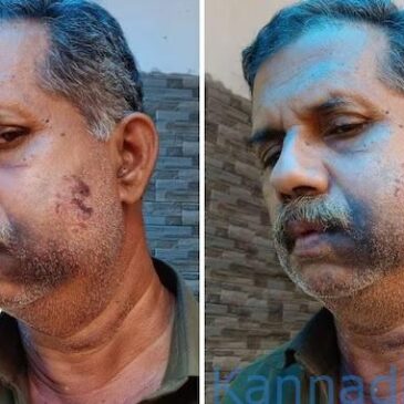 ಅವರು 4ನೇ ತರಗತಿಯಲ್ಲಿದ್ದಾಗ ಹೊಡೆದಾಡಿಕೊಂಡಿದ್ರು… ಈಗ 50 ವರ್ಷಗಳ ನಂತರ ಭೇಟಿಯಾದಾಗ ಥಳಿಸಿ ಸೇಡು ತೀರಿಸಿಕೊಂಡ್ರು…!