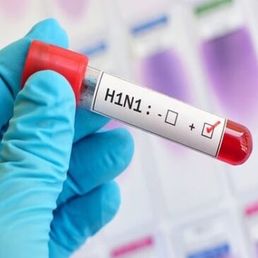 ಕರ್ನಾಟಕದಲ್ಲಿ 4 ಸಾವಿರ ದಾಟಿದ  H1N1 ಸೋಂಕು